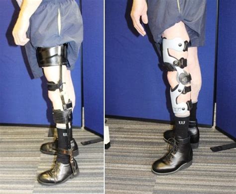 callipers legs|Lightweight Callipers & Knee Braces: Knee.